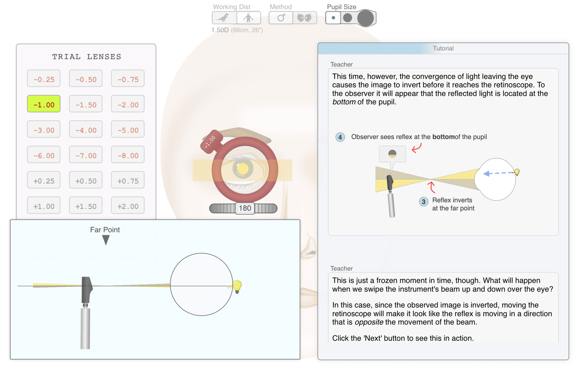 Retinoscopy tutorial screenshot